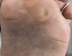 Студия подологии и эстетики IloNails studio (ИлоНеилс студио), Подология - фото 2