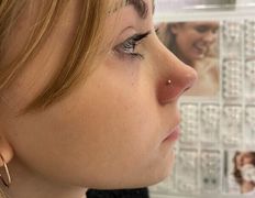 Косметический кабинет Alisan-med (Алисан-мед), Примеры работ - фото 17