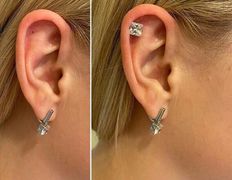 Косметический кабинет Alisan-med (Алисан-мед), Примеры работ - фото 11