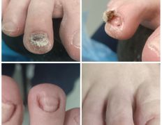 Студия подологии PodoArt (ПодоАрт), Примеры работ - фото 2