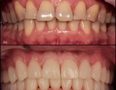 Стоматология Триомед, Примеры работ - фото 2