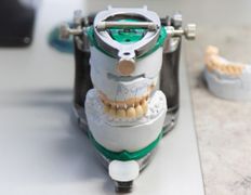 Стоматология с имплантацией Новая улыбка, Новая улыбка - фото 18