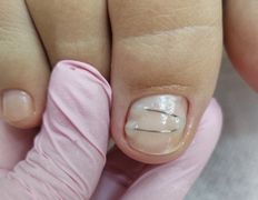 Салон красоты Шевелюра, Подология - фото 1