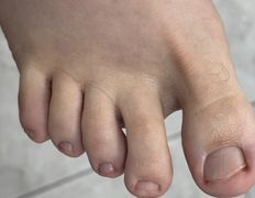 Студия подологии и эстетики IloNails studio (ИлоНеилс студио), Подология - фото 19