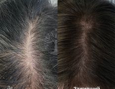 Студия красоты INTUITION (Интуишн), Трихопигментация - фото 3