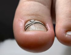 Центр подологии и маникюра Студия 56, Подология - фото 10