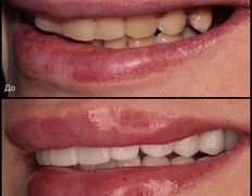 Стоматология Триомед, Примеры работ - фото 6