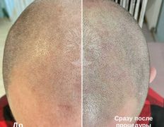 Студия красоты INTUITION (Интуишн), Трихопигментация - фото 6