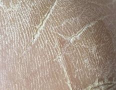 Эстетический центр Grandessa (Грандесса), Педикюр ADN - фото 2