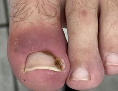 Студия подологии и эстетики IloNails studio (ИлоНеилс студио), Подология - фото 16