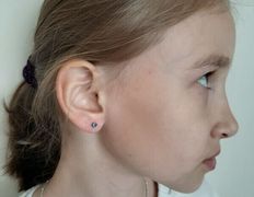 Эстетический центр Grandessa (Грандесса), Прокол ушей и пирсинг - фото 1