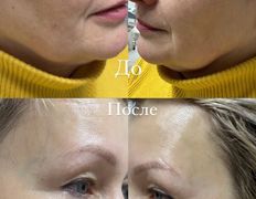 null Студия косметических услуг Цыганенко Екатерины, Процесс - фото 5