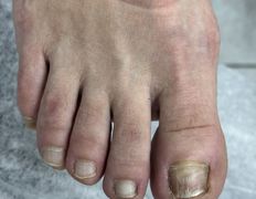 Студия подологии и эстетики IloNails studio (ИлоНеилс студио), Подология - фото 20