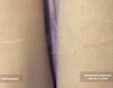 Студия красоты INTUITION (Интуишн), Эстетический камуфляж - фото 6