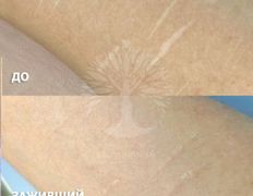 Студия красоты INTUITION (Интуишн), Эстетический камуфляж - фото 1