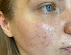 null Косметический кабинет Юлии Смирновой, Галерея - фото 5