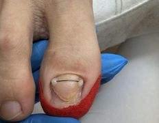 null Центр подологии и эстетики Ольги Дударевич, Примеры работ - фото 1