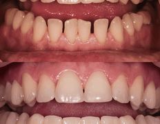 Стоматология Триомед, Примеры работ (ортопедия) - фото 1