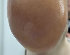 Студия подологии и эстетики IloNails studio (ИлоНеилс студио), Подология - фото 3