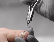 Центр подологии и маникюра Студия 56, Подология - фото 3