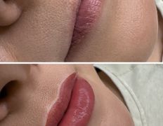 Салон красоты La Stella (Ла Стелла), Перманентный макияж - фото 18
