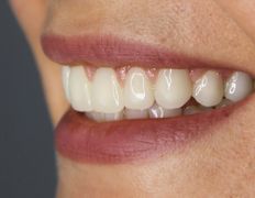 Стоматология Евро-Стом, Галерея - фото 10