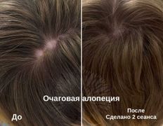 Студия красоты INTUITION (Интуишн), Трихопигментация - фото 5