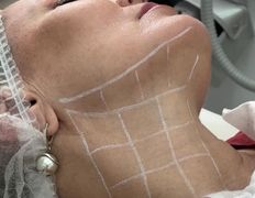 Центр медицинской косметологии Теорема красоты, Рабочий процесс - фото 18