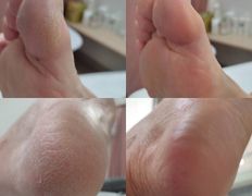 Студия ногтевого сервиса VVStudio (ВВСтудио), Подология - фото 6