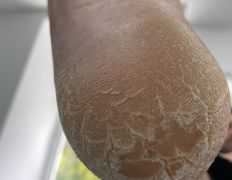 Студия подологии и эстетики IloNails studio (ИлоНеилс студио), Подология - фото 8