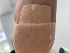 Студия подологии и эстетики IloNails studio (ИлоНеилс студио), Подология - фото 7