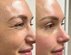 Эстетик центр Изуми, Примеры работ - фото 2