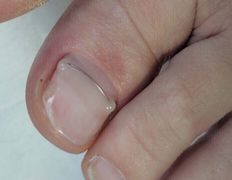 Студия ногтевого сервиса VVStudio (ВВСтудио), Подология - фото 19