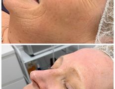 Эстетик центр Изуми, Примеры работ - фото 1