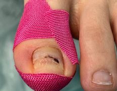 Студия подологии и эстетики  Moipodolog (Мой подолог), Подология - фото 2