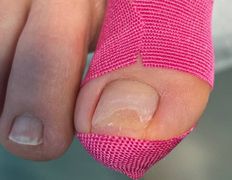 Студия подологии и эстетики  Moipodolog (Мой подолог), Подология - фото 4