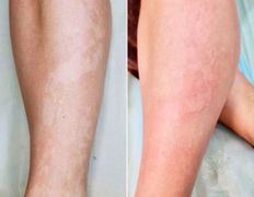 Студия красоты INTUITION (Интуишн), Эстетический камуфляж - фото 2