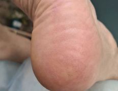 Эстетический центр Grandessa (Грандесса), Педикюр ADN - фото 3