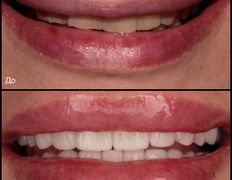 Стоматология Триомед, Примеры работ - фото 4