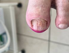 Студия подологии и эстетики  Moipodolog (Мой подолог), Подология - фото 18