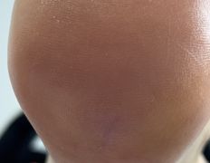 Студия подологии и эстетики IloNails studio (ИлоНеилс студио), Подология - фото 4