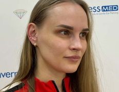 Косметический кабинет Inverness (Инвернесс), Прокол ушей, хряща - фото 13