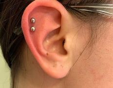 Косметический кабинет Медикал Бьюти на Грушевке, Примеры работ - фото 1