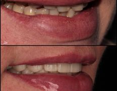 Стоматология Триомед, Примеры работ - фото 3