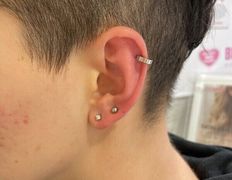 Косметический кабинет Alisan-med (Алисан-мед), Примеры работ - фото 19