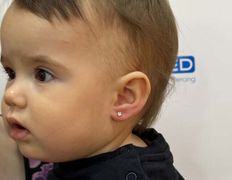 Косметический кабинет Inverness (Инвернесс), Прокол ушей, хряща - фото 8