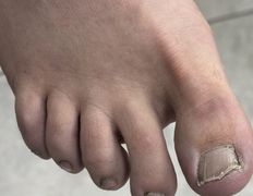 Студия подологии и эстетики IloNails studio (ИлоНеилс студио), Подология - фото 18