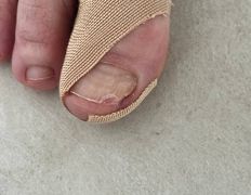 Студия подологии и эстетики  Moipodolog (Мой подолог), Подология - фото 16