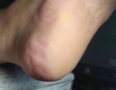 Эстетический центр Grandessa (Грандесса), Педикюр ADN - фото 5