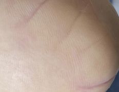 Эстетический центр Grandessa (Грандесса), Педикюр ADN - фото 4